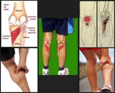 La giusta postura per correre. I consigli del chiropratico